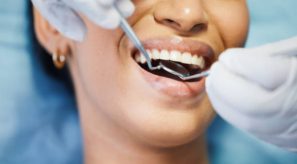 Best Emergency Dental Filling Replacement  in Lake Mills, IA